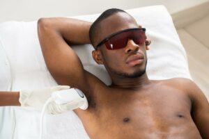 Laser Hair removal at Simply Skin Deep in Bryanston Sandton