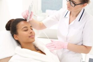 Microneedling at simply skin deep in Bryanston, Sandton