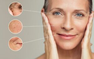 hifu anti aging at simply skin deep in Bryanston, Sandton