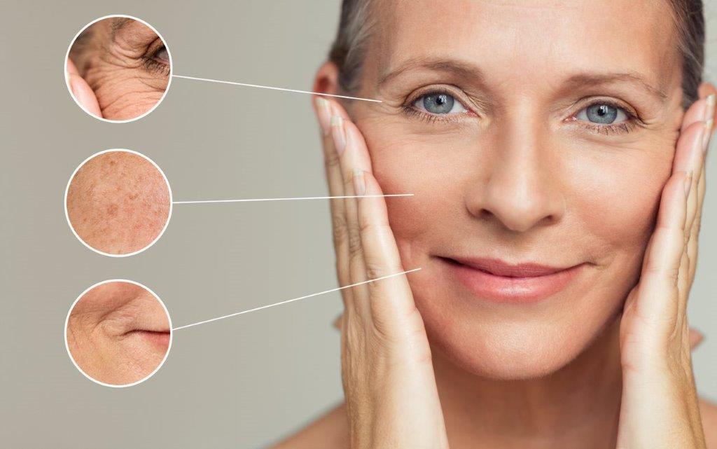 hifu anti aging at simply skin deep in Bryanston, Sandton